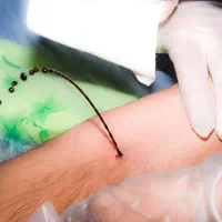 زالو،حجامت،فصد خون،مشاوره طب سنتی عباسیه نجف آباد|خدمات آرایشگری و زیبایی|یزد, |دیوار