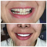 کامپوزیت،ارتودنسی،ایمپلنت|خدمات آرایشگری و زیبایی|بردسکن, |دیوار