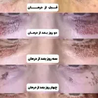 جراحی بینی ابدو،چربی لیپو 360ترانسفر باسن بیکینی|خدمات آرایشگری و زیبایی|اندیشه, اندیشه فاز ۱|دیوار