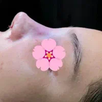 عمل بینی ۲۳ میلیون در تخفیفات|خدمات آرایشگری و زیبایی|تهران, میدان ولیعصر|دیوار
