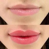 مدل شیدینگ لب وبنمژه کار توسط استاد در کلینیک پزشک|خدمات آرایشگری و زیبایی|مشهد, احمدآباد|دیوار
