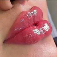 تخفیف ویژه مزو،آنزیم،ژل با بیحسی دندانپزشکی از ۴۰۰|خدمات آرایشگری و زیبایی|گرگان, |دیوار