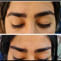 فیلر لب چانه گونه زاویه بوتاکس هایفو ژل مزو لیزر|خدمات آرایشگری و زیبایی|مشهد, فرهنگ|دیوار
