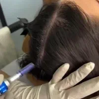 تزریق ژل و بوتاکس و کاشت نخ در کلینیک زیبایی|خدمات آرایشگری و زیبایی|خرم‌آباد, |دیوار