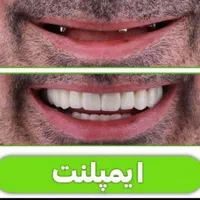 مرکز تخصصی ایمپلنت، مطب دندانپزشکی باقیمتی کم نظیر|خدمات آرایشگری و زیبایی|شیراز, قصرالدشت|دیوار