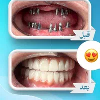 کلینیک تخصصی دندانپزشکی و ایمپلنت  در سیرجان|خدمات آرایشگری و زیبایی|سیرجان, |دیوار