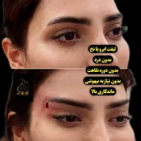 لیفت نخ معجزه جوانی و لیفتینگ صورت بدون جراحی|خدمات آرایشگری و زیبایی|شاهین‌شهر, فردوسی|دیوار