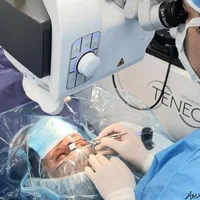 چشم پزشکی حذف دائم عینک فمتولیزیک لازک ترنسPRK|خدمات آرایشگری و زیبایی|یاسوج, |دیوار