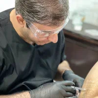 با بوتاکس از شر تعریق زیر بغل راحت شو