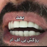 دندانپزشکی و دندان سازی خیریه چمران (جراحی. زیبایی|خدمات آرایشگری و زیبایی|تهران, امام حسین|دیوار