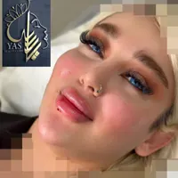 تزریق ژل وبوتاکس ومادلینگ اروپایی وهایفو درکلینیک