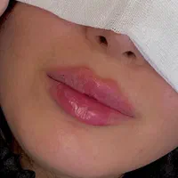 تزریق ژل ،390مزو لیزر بوتاکس مصپورت بانوان آقایان|خدمات آرایشگری و زیبایی|تهران, صادقیه|دیوار
