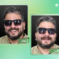 کلینیک تخصصی ایمپلنت دیجیتال5400/فوری/کاشت دندان|خدمات آرایشگری و زیبایی|تهران, پاسداران|دیوار