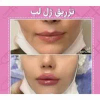 جشنواره جوانساز صورت بامزوجوانساز برای آقاها،خانم
