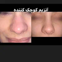 آنزیم ژل لب.بینی.غعبغب. ژل های گلوله شده چربی سوز