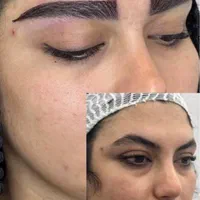 کاشت مو ابرو ریش سیبیل در مشهد توسط متخصص پوست|خدمات آرایشگری و زیبایی|مشهد, ملک‌آباد|دیوار