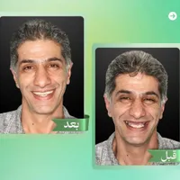 کلینیک تخصصی ایمپلنت دیجیتال5400/فوری/کاشت دندان|خدمات آرایشگری و زیبایی|تهران, پاسداران|دیوار