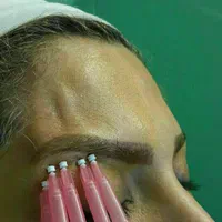 آموزش هیالورون پن کاشتمو آموزشگاه ژل بوتاکس|خدمات آموزشی|تهران, ستارخان|دیوار