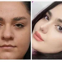 عمل بینی/پیکرتراشی /فقط با 20 /اقساطی ماهی پنج|خدمات آرایشگری و زیبایی|شیراز, زرگری|دیوار