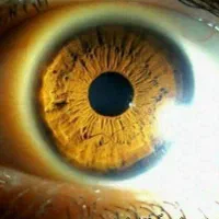 حجامت.زالودرمانی.طب سوزنی.چاقی.لاغری|خدمات آرایشگری و زیبایی|مشهد, رسالت|دیوار