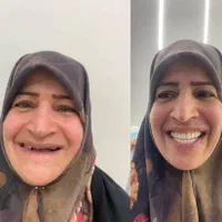 کلیه خدمات دندانپزشکی/اقساط12ماهه/بدون کارمزد|خدمات آرایشگری و زیبایی|قم, حنیف نژاد|دیوار