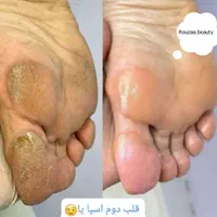 کراتین،اپیلاسیون پاکسازی رنگ اصلاح(کوی نیایش)|خدمات آرایشگری و زیبایی|بندرعباس, |دیوار