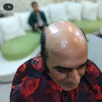 ترمیم موی|خدمات آرایشگری و زیبایی|ری, دیلمان|دیوار