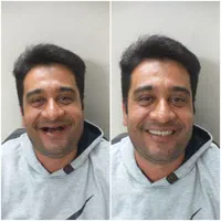 خدمات دندان مصنوعی|خدمات آرایشگری و زیبایی|اصفهان, ارداجی|دیوار
