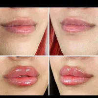 کلینیک زیبایی آرزو پوست. مو.لیزر