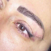 بلفاروپلاستی/ جراحی پلک / لیفت ابرو/ سانترال لب|خدمات آرایشگری و زیبایی|تهران, صادقیه|دیوار