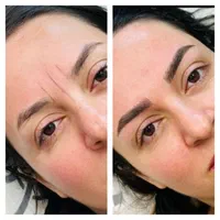 میکروبلیدینگ ،فیبروز،ارایش دائم،کراتین|خدمات آرایشگری و زیبایی|مشهد, نوید|دیوار