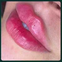 ژل لب روسی وعروسکی از ۸۰۰ ،بوتاکس۷۰۰ پی ارپی۷۰۰|خدمات آرایشگری و زیبایی|مشهد, فلسطین|دیوار