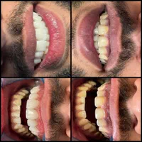 ارتودنسی توسط متخصص،دندانپزشکی اطفال،متخصص زیبایی|خدمات آرایشگری و زیبایی|اصفهان, هفتون|دیوار