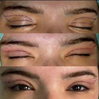 جذب پزشک متخصص و فوق تخصص چشم|استخدام درمانی، زیبایی، بهداشتی|تهران, قیطریه|دیوار