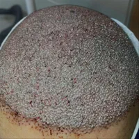 کاشت مو و ابرووریش حداکثر تراکم باضمانت نامه کتبی|خدمات آرایشگری و زیبایی|شیراز, عفیف‌آباد|دیوار