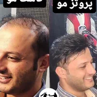 پروتز مو و چسب پروتز مو شیراز|خدمات آرایشگری و زیبایی|شیراز, ملاصدرا|دیوار
