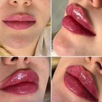بوتاکس وژل.مزوسر   فقط۳۵۰|خدمات آرایشگری و زیبایی|کرج, بنیاد|دیوار