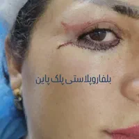مژده ب همشهریان عزیزم آف چهل درصدی جراحی زیبایی|خدمات آرایشگری و زیبایی|دورود, |دیوار