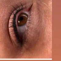 میکروبلیدینگ و میکروپیگمنتیشن صورت الی|خدمات آرایشگری و زیبایی|تهران, هفت چنار|دیوار