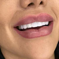 دندانپزشکی.لمینت.ایمپلنت.|خدمات آرایشگری و زیبایی|اصفهان, جلفا|دیوار