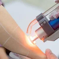 لیزر دستگاه کندلا مکس پرو لیزر پلکسر میکروسوییچ|خدمات آرایشگری و زیبایی|اصفهان, برازنده|دیوار