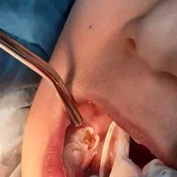 دندانپزشکی اطفال کودک‌ و نوجوان فردیس کرج|خدمات آرایشگری و زیبایی|فردیس, فردیس|دیوار