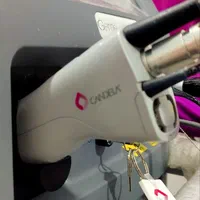 لیزر موی زائد الکس کندلا آمریکایی 2022 (شوش)|خدمات آرایشگری و زیبایی|شوش, |دیوار