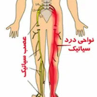 حجامت،فصد،زالودرمانی، زیر نظر پزشک|خدمات آرایشگری و زیبایی|اصفهان, شهرک زاینده رود|دیوار