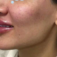 استخدام پزشک زیبایی