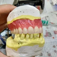 لابراتوار ساخت دندان مصنوعی ( Diamon Dent )