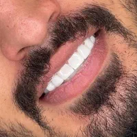 دندانپزشکی.لمینت.ایمپلنت.|خدمات آرایشگری و زیبایی|اصفهان, جلفا|دیوار