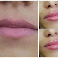 خدمات ژل وبوتاکس. تتو وانزیم وپرسینگ|خدمات آرایشگری و زیبایی|مشهد, شهرک شهید باهنر|دیوار