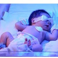 اجاره دستگاه زردی (فتوتراپی)نوزاد|خدمات آرایشگری و زیبایی|اهواز, کیانپارس |دیوار