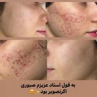 فیشال و خدمات تخصصی پوست توسط پیراپزشک در مطب پزشک|خدمات آرایشگری و زیبایی|مشهد, سجاد شهر|دیوار